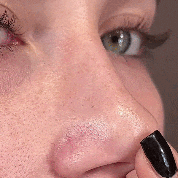 OVERNIGHT PORE PATCHES